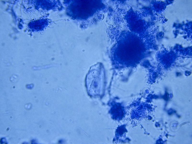dampak methylene blue